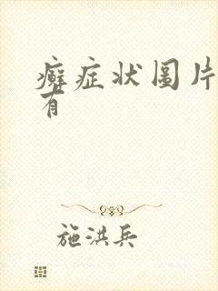 癣症状图片哪里有
