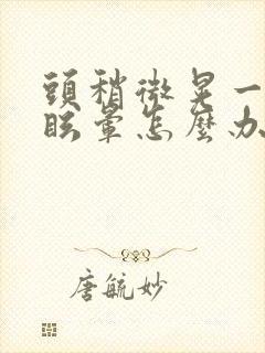 头稍微晃一下就眩晕怎么办