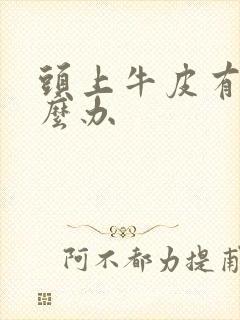 头上牛皮有癣怎么办