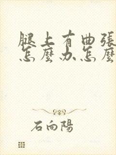 腿上有曲张静脉怎么办怎么治的好