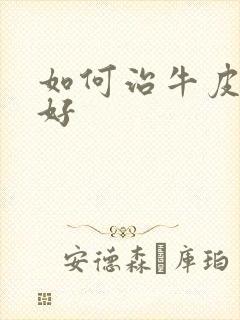 如何治牛皮有癣好