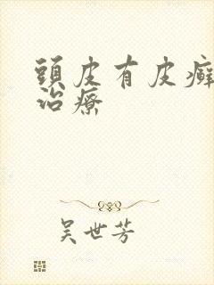 头皮有皮癣怎么治疗