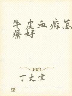 牛皮血癣怎么治疗好