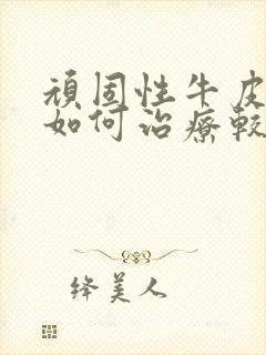 顽固性牛皮血癣如何治疗较好