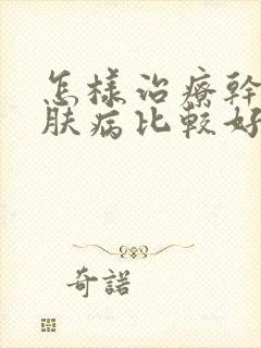 怎样治疗干癣皮肤病比较好