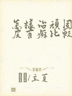 怎样治顽固性牛皮有癣比较好