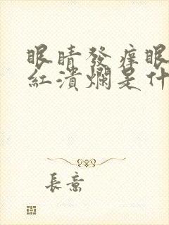 眼睛发痒眼角发红溃烂是什么原因