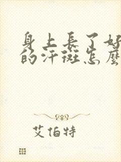 身上长了好多年的汗斑怎么治