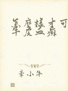 怎么样才可以去牛皮血癣