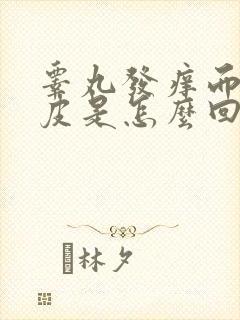 睾丸发痒而且脱皮是怎么回事