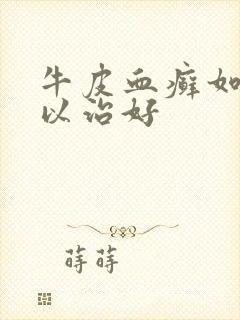 牛皮血癣如何可以治好