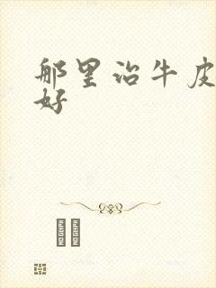 那里治牛皮血癣好