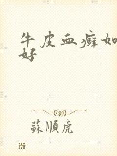 牛皮血癣如何治好