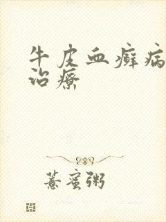 牛皮血癣病怎么治疗