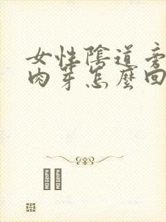 女性阴道旁边长肉芽怎么回事