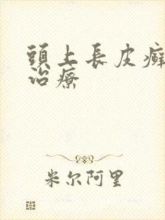 头上长皮癣怎么治疗