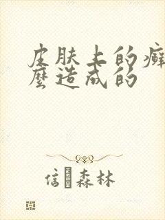 皮肤上的癣是什么造成的封面