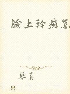 脸上干癣怎么办