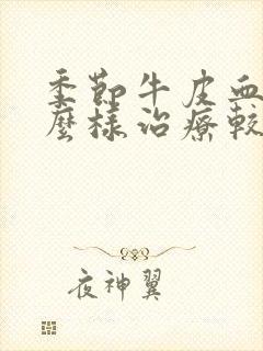 季节牛皮血癣怎么样治疗较好