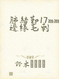肺结节17mm边缘毛刺