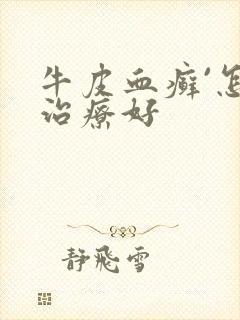 牛皮血癣`怎么治疗好