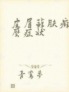 皮屑藓肤癣有什么症状