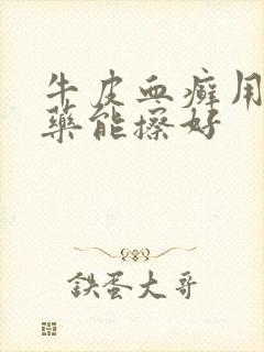 牛皮血癣用什么药能擦好