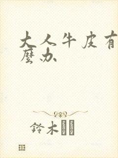 大人牛皮有癣怎么办