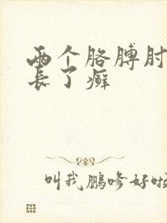 两个胳膊肘对称长了癣