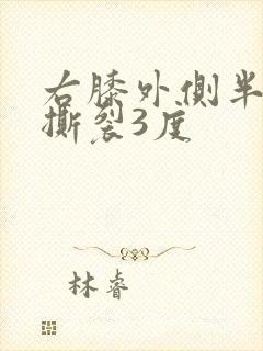 右膝外侧半月板撕裂3度封面