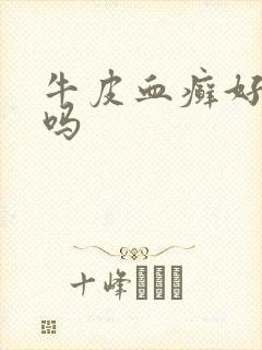 牛皮血癣好治疗吗封面