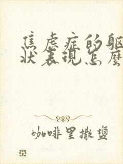 焦虑症的躯体症状表现怎么样缓解封面