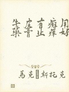 牛皮有癣用什么药膏止痒好的快点
