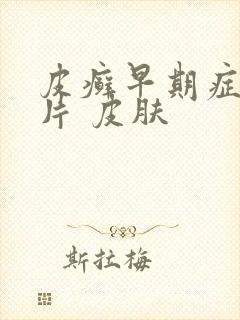 皮癣早期症状图片 皮肤