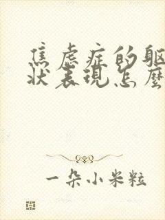 焦虑症的躯体症状表现怎么样缓解封面