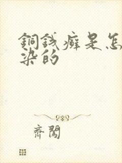 铜钱癣是怎么感染的
