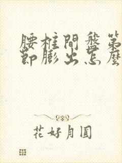腰椎间盘第三四节膨出怎么治疗