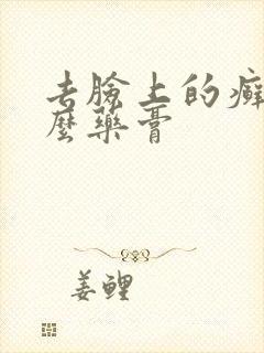 去脸上的癣用什么药膏