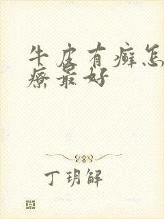 牛皮有癣怎么治疗最好