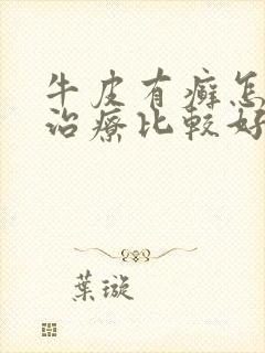 牛皮有癣怎么样治疗比较好