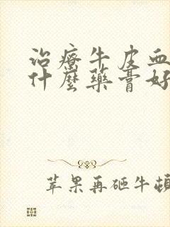 治疗牛皮血癣用什么药膏好