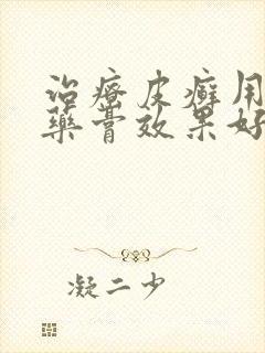 治疗皮癣用什么药膏效果好
