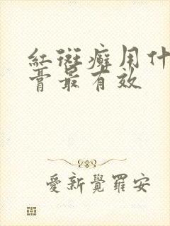 红斑癣用什么药膏最有效