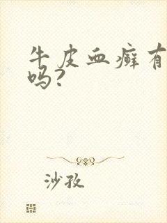 牛皮血癣有得治吗?
