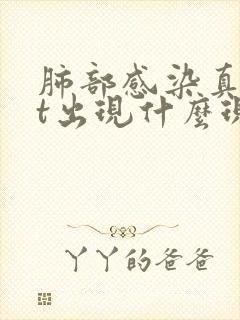 肺部感染真菌ct出现什么现象