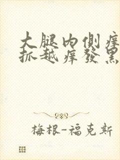 大腿内侧痒痒越抓越痒发黑用什么药