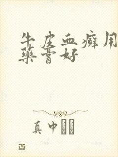 牛皮血癣用什么药膏好