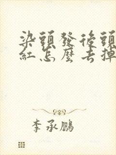 染头发后头皮发红怎么去掉