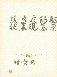焦虑症的躯体症状表现怎么样缓解