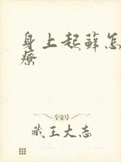 身上起藓怎么治疗